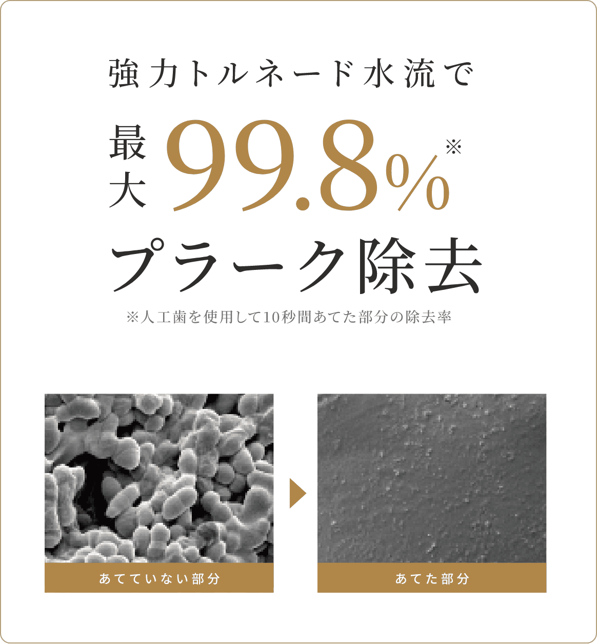 ジェットフロス特徴1